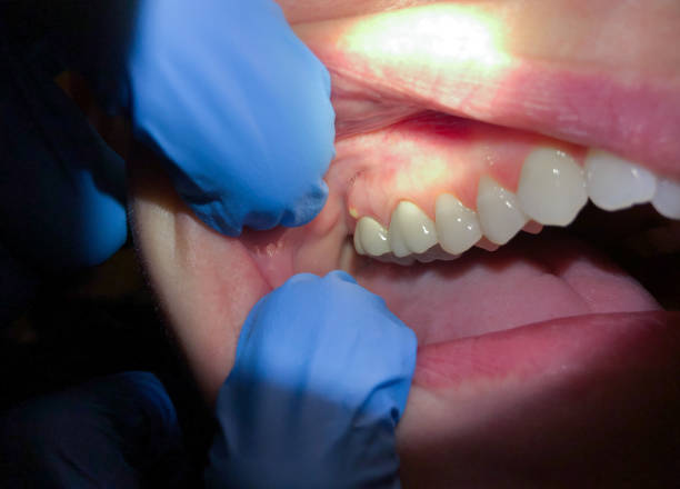 Reliable RI Emergency Dentist Solutions